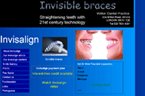 Invisible Braces